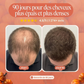 Gélules d'huile de pépins de Courge